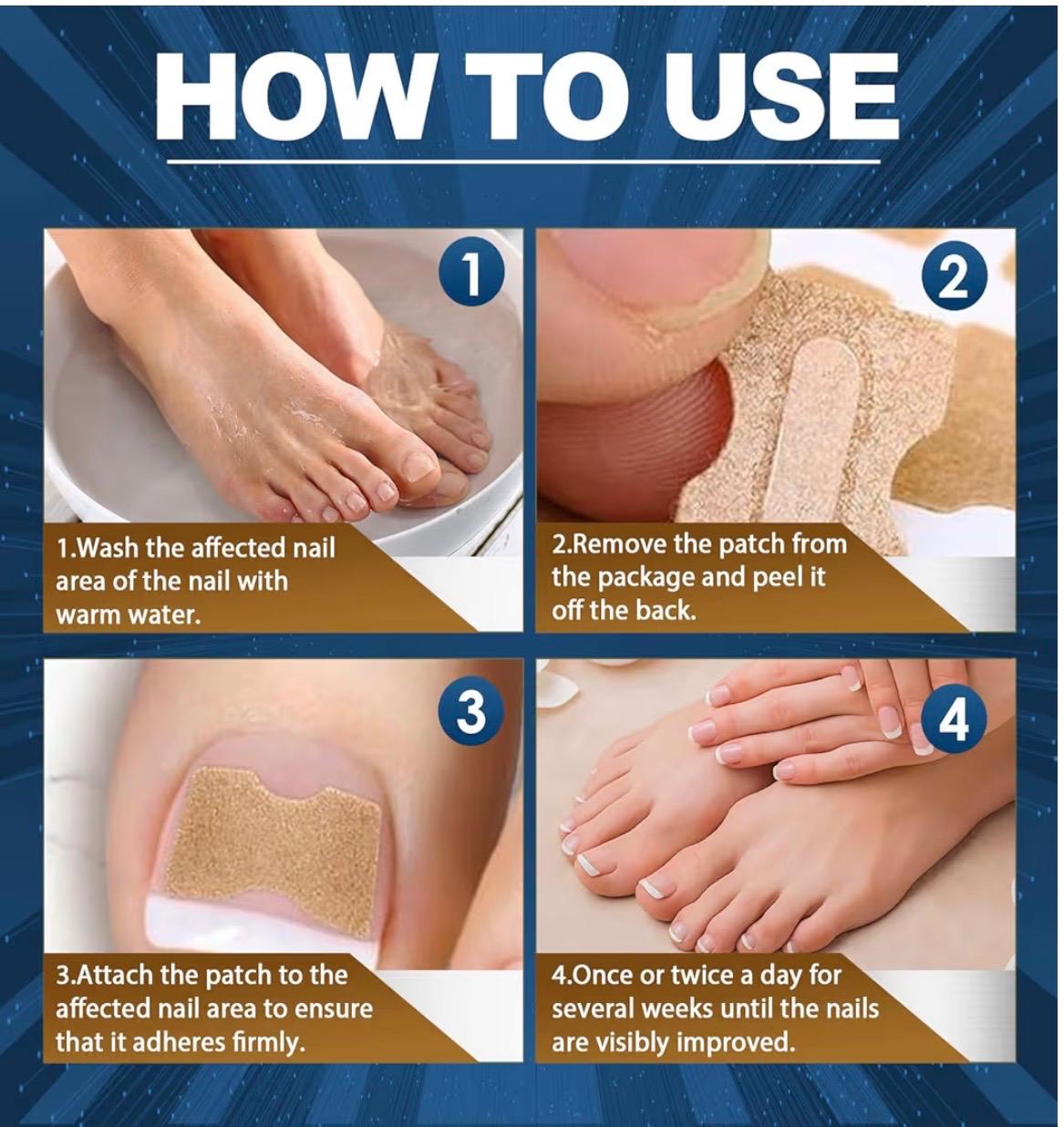 Parche anti-hongos de uñas de acción intensiva.  Recupera la confianza en tus pies con un tratamiento fácil, discreto y efectivo desde casa.,
