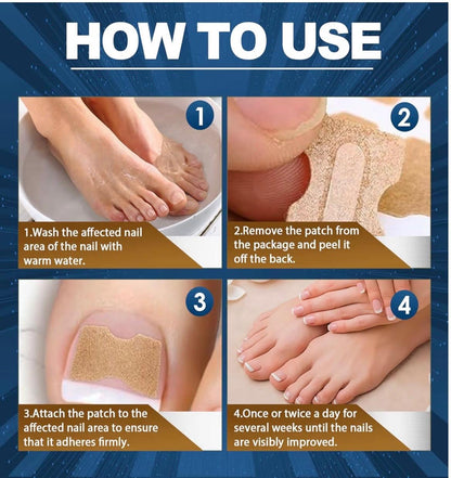 Parche anti-hongos de uñas de acción intensiva.  Recupera la confianza en tus pies con un tratamiento fácil, discreto y efectivo desde casa.,